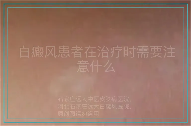 白癜风患者在治疗时需要注意什么