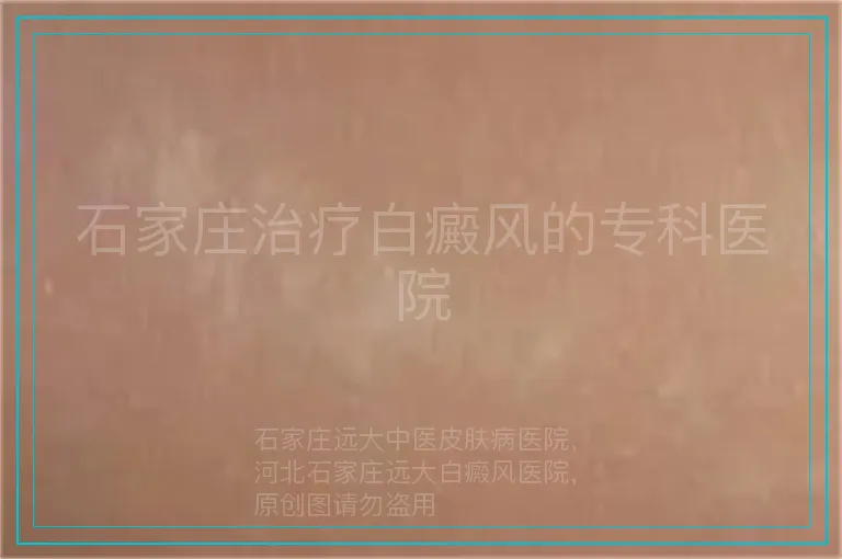 石家庄治疗白癜风的专科医院