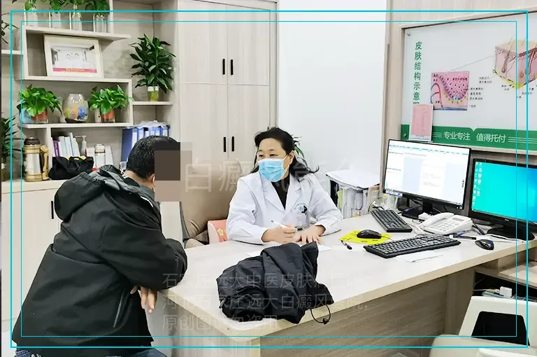 白癜风能么