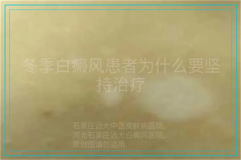 冬季白癜风患者为什么要坚持治疗