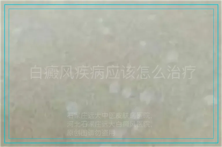 白癜风疾病应该怎么治疗