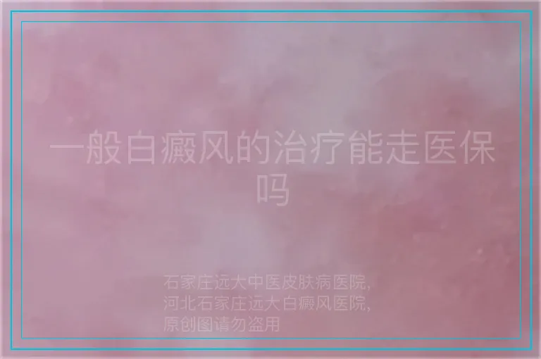 一般白癜风的治疗能走医保吗