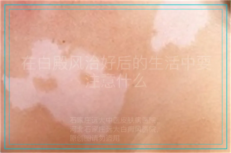 在白殿风治好后的生活中要注意什么