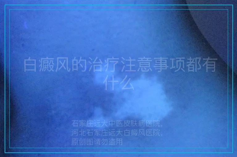白癜风的治疗注意事项都有什么