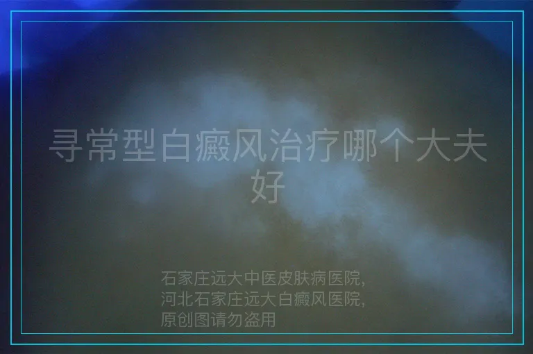 寻常型白癜风治疗哪个大夫好