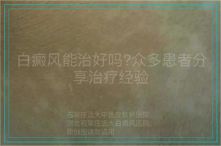 白癜风能治好吗?众多患者分享治疗经验