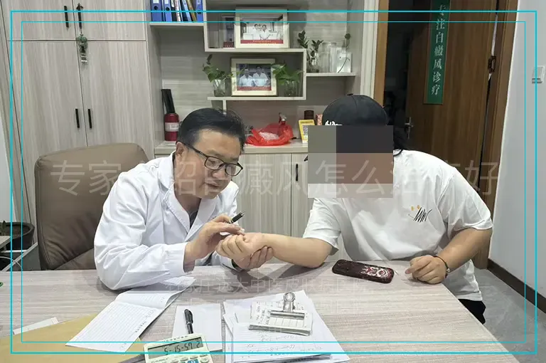 专家介绍白癜风怎么治疗好