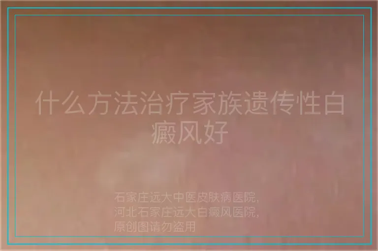 什么方法治疗家族遗传性白癜风好