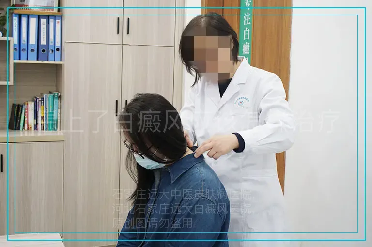 患上了白癜风应该怎样治疗