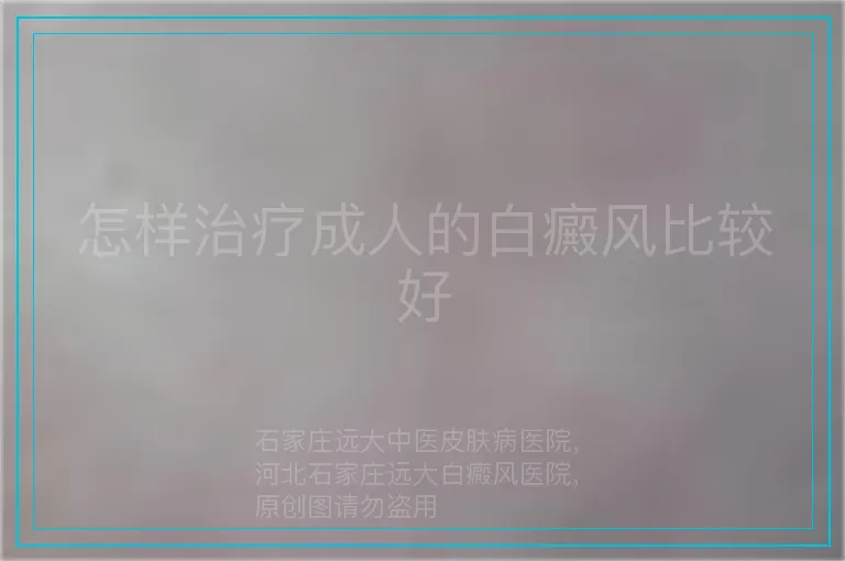 怎样治疗成人的白癜风比较好