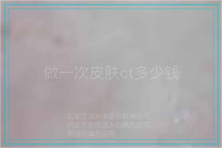做一次皮肤ct多少钱