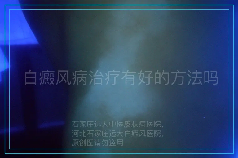 白癜风病治疗有好的方法吗
