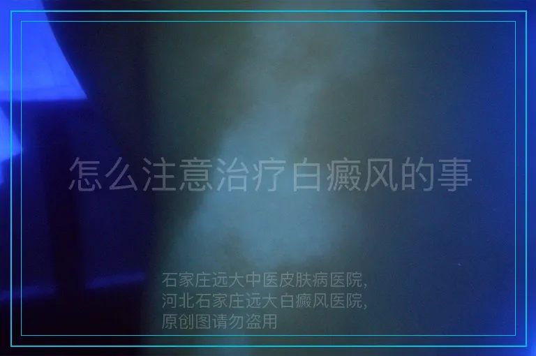 怎么注意治疗白癜风的事
