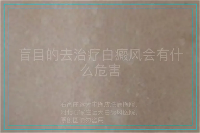 盲目的去治疗白癜风会有什么危害
