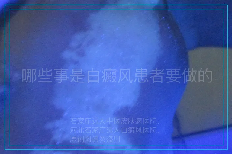 哪些事是白癜风患者要做的