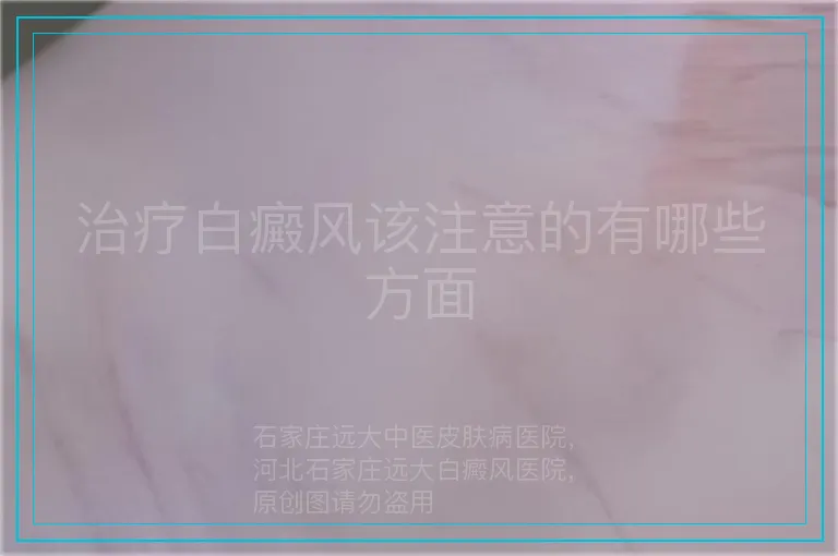 治疗白癜风该注意的有哪些方面