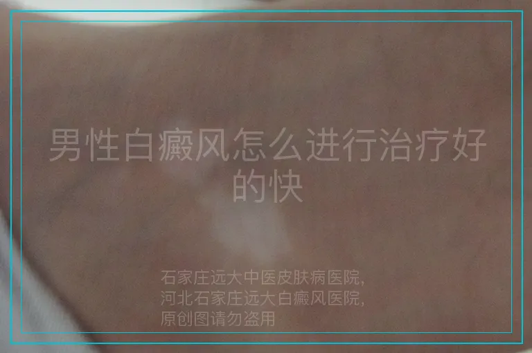 男性白癜风怎么进行治疗好的快