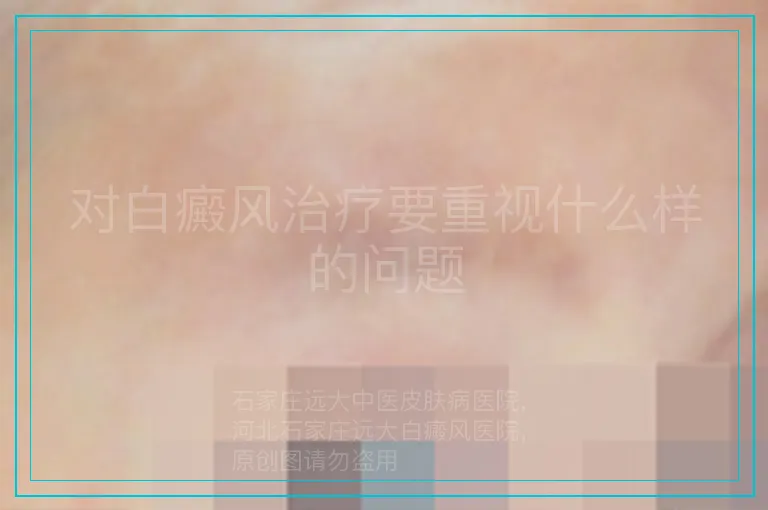 对白癜风治疗要重视什么样的问题