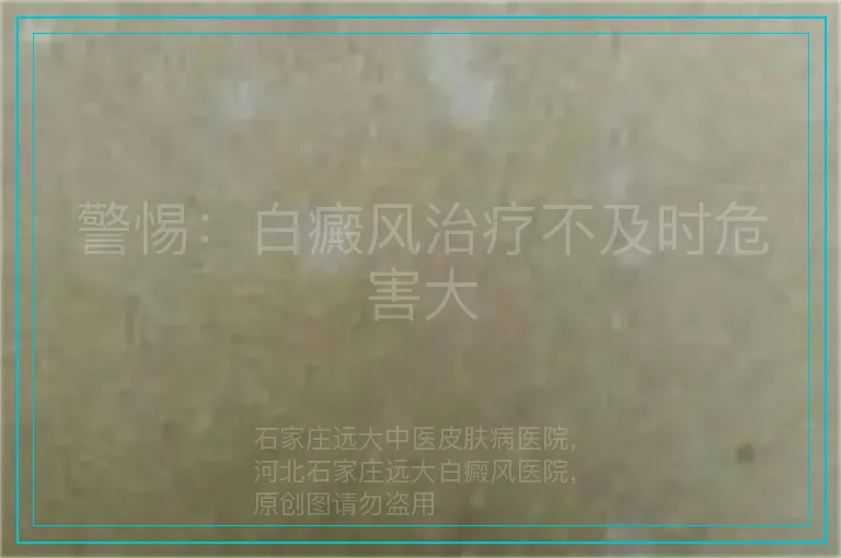 警惕：白癜风治疗不及时危害大