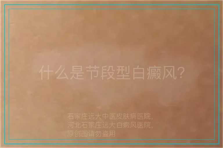 什么是节段型白癜风？