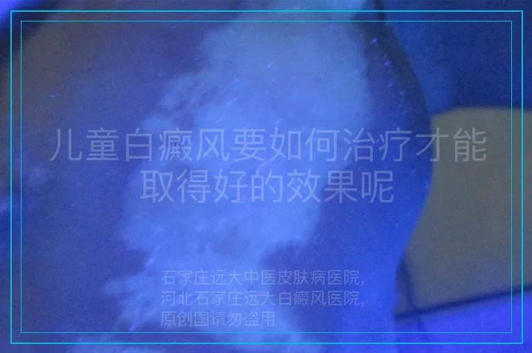 儿童白癜风要如何治疗才能取得好的效果呢