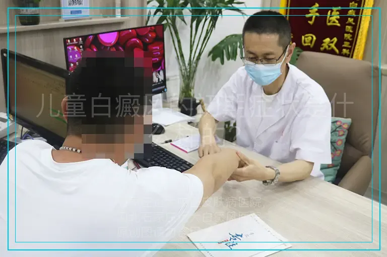 儿童白癜风的初期症状是什么样的?