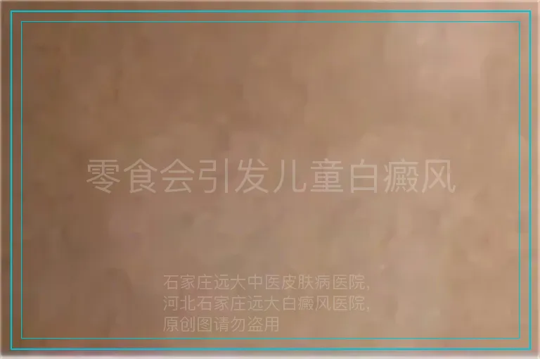 零食会引发儿童白癜风