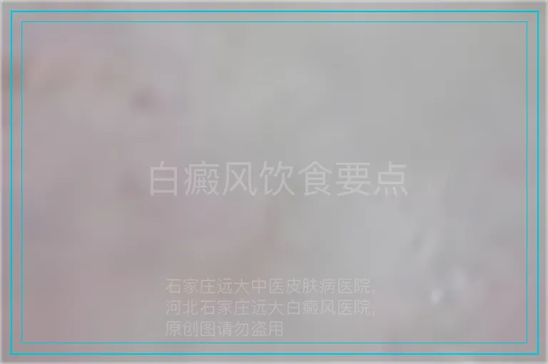 白癜风饮食要点