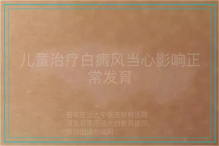 儿童治疗白癜风当心影响正常发育