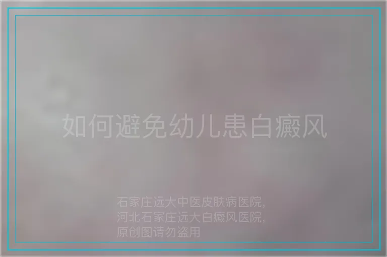 如何避免幼儿患白癜风