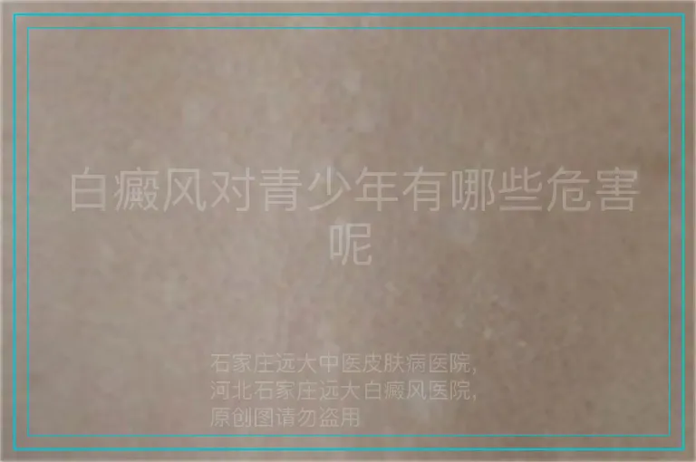 白癜风对青少年有哪些危害呢
