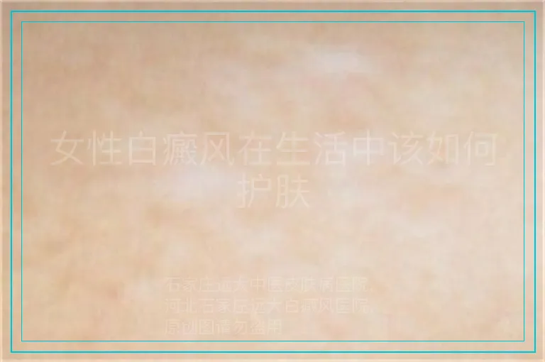 女性白癜风在生活中该如何护肤