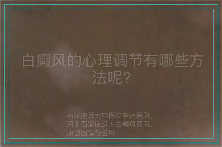 白癜风的心理调节有哪些方法呢?