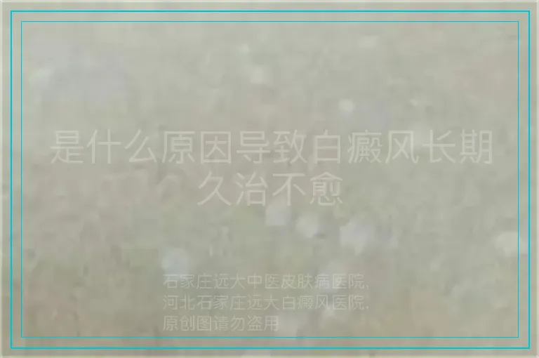 是什么原因导致白癜风长期久治不愈