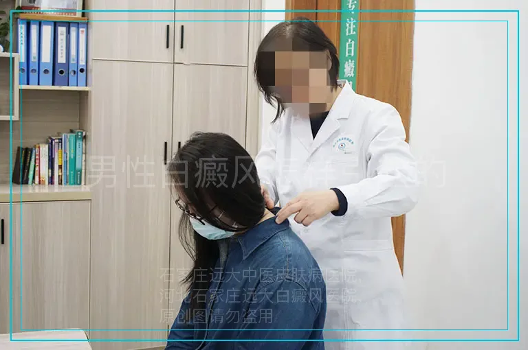 男性白癜风怎样引起的