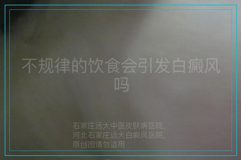不规律的饮食会引发白癜风吗