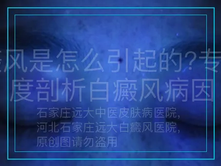 白癜风是怎么引起的?专家深度剖析白癜风病因
