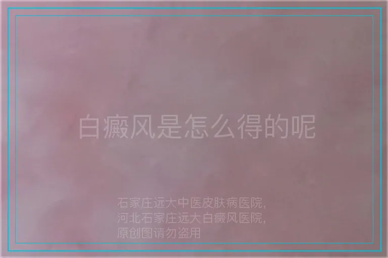 白癜风是怎么得的呢