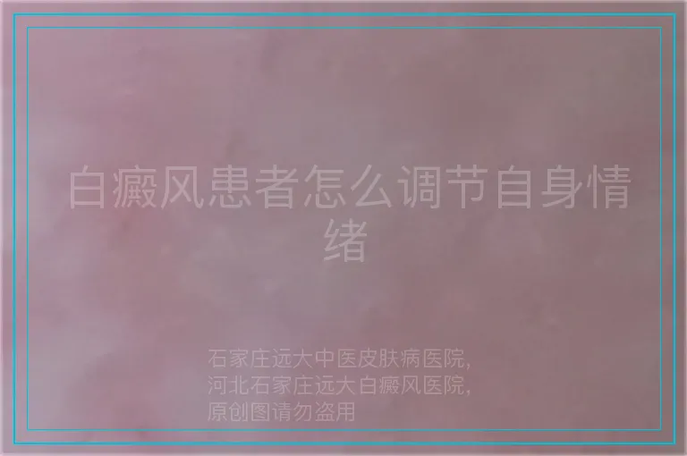 白癜风患者怎么调节自身情绪