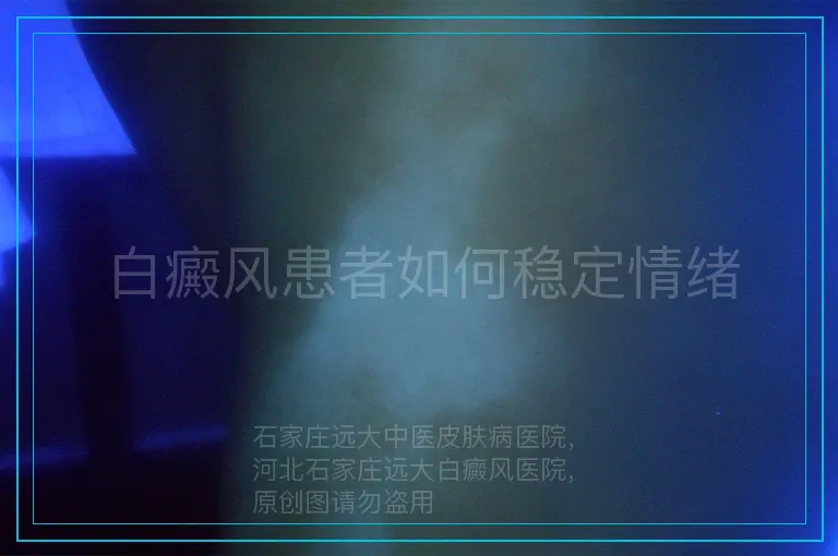 白癜风患者如何稳定情绪
