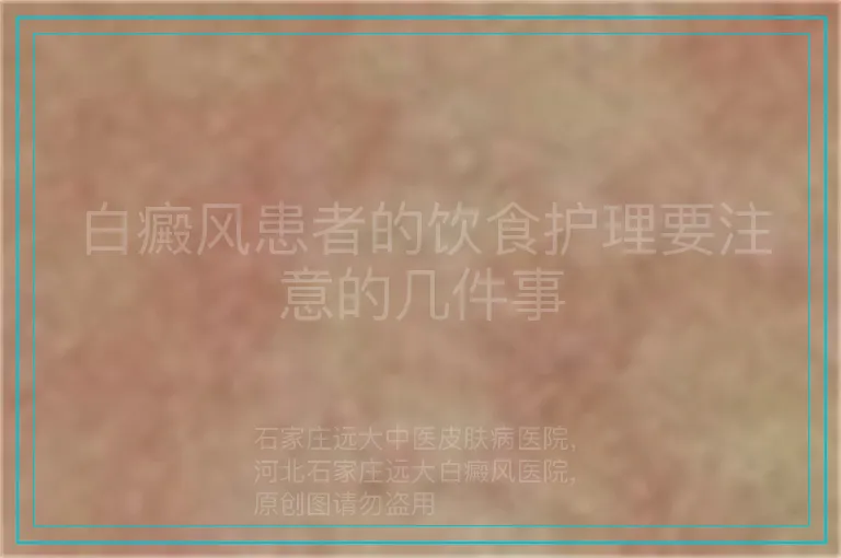 白癜风患者的饮食护理要注意的几件事