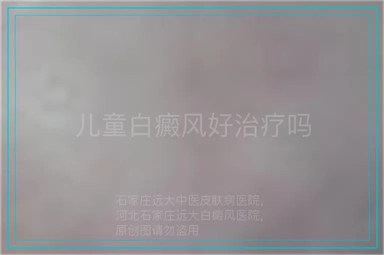 儿童白癜风好治疗吗