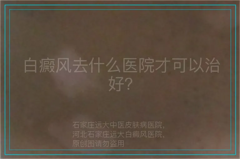 白癜风去什么医院才可以治好？
