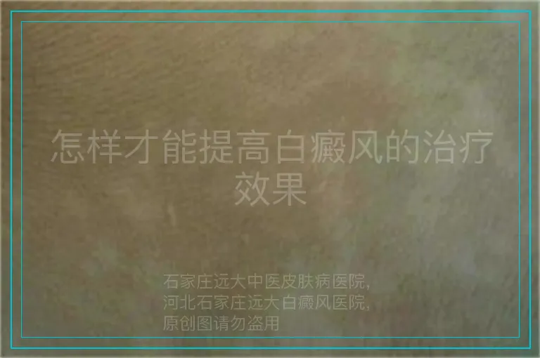 怎样才能提高白癜风的治疗效果