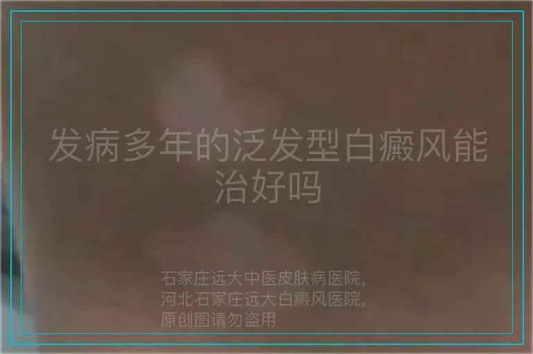 发病多年的泛发型白癜风能治好吗