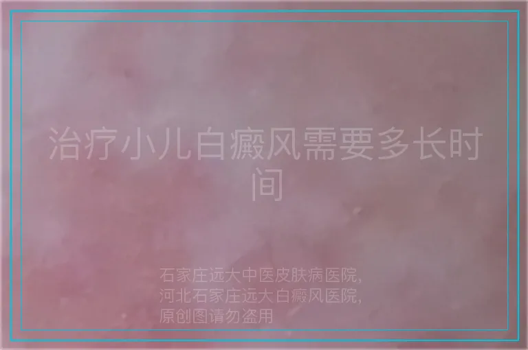 治疗小儿白癜风需要多长时间