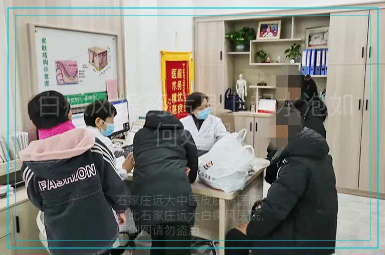 白癜风擦药后身上起水泡如何处理