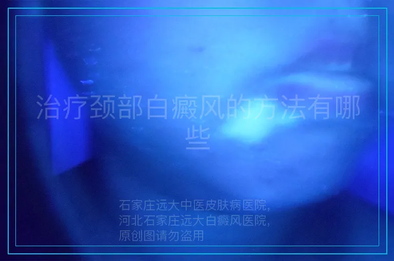 治疗颈部白癜风的方法有哪些