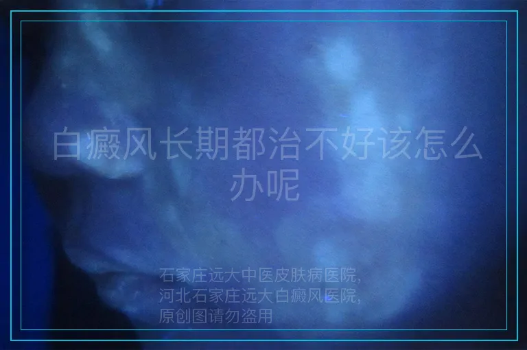 白癜风长期都治不好该怎么办呢