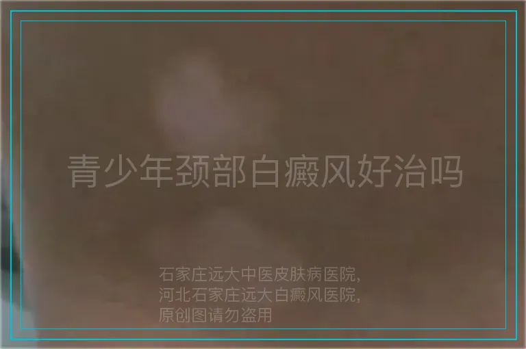 青少年颈部白癜风好治吗
